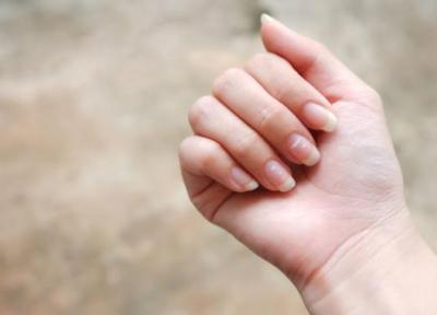 8 دلیل به وجود آمدن لکه سفید روی ناخن که بهتر است بدانید